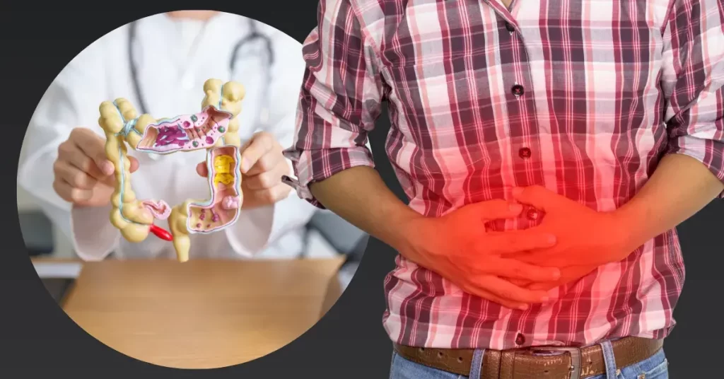 valor de uma cirurgia de diverticulite