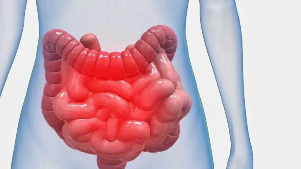 7 Sinais Silenciosos de que Sua Saúde Intestinal Não Vai Bem